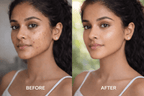 Glowstiq Acne-Free Radiance Serum