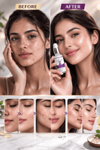 Niacinamide Serum for Pores and Oil Control